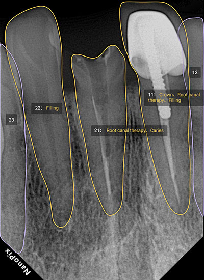Tooth